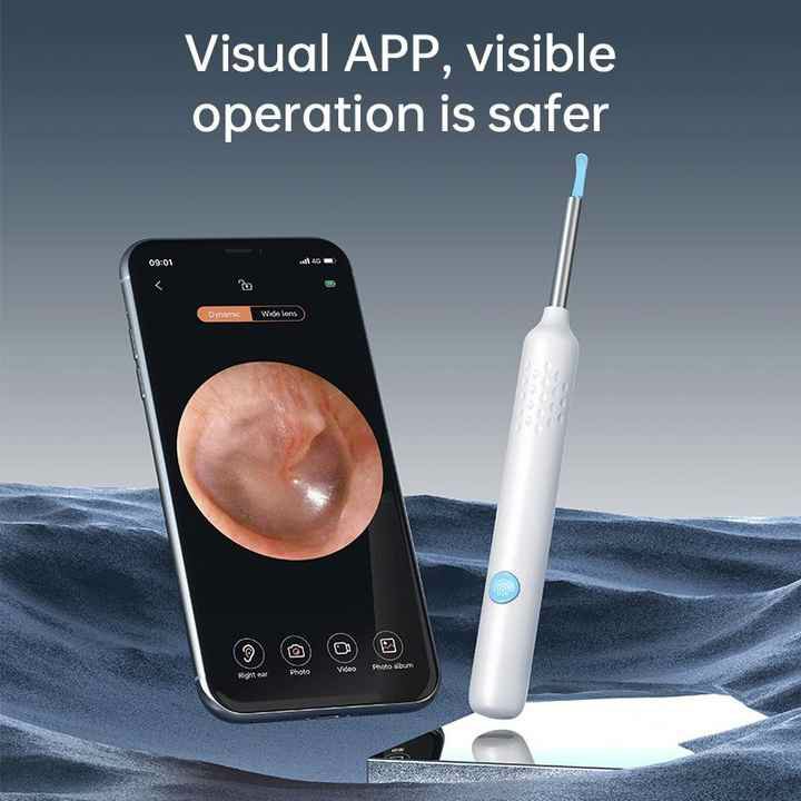 Smart Visual Otoscope - Ear Cleaner
