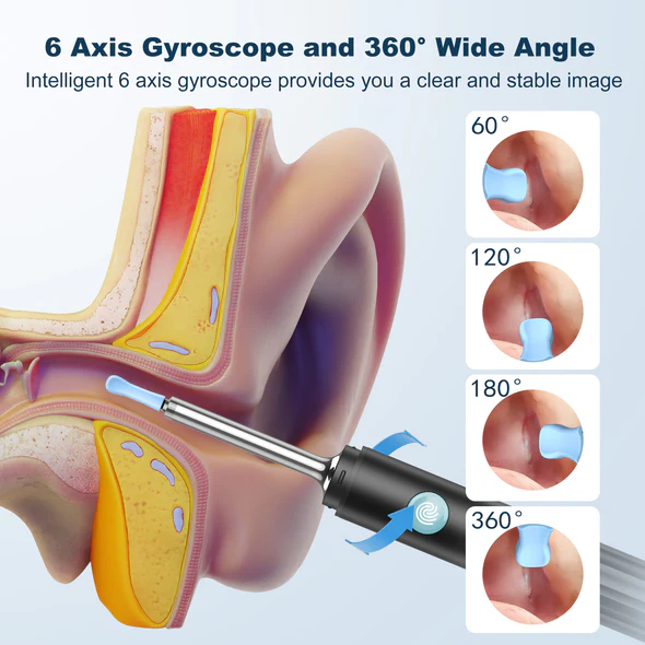 Smart Visual Otoscope - Ear Cleaner